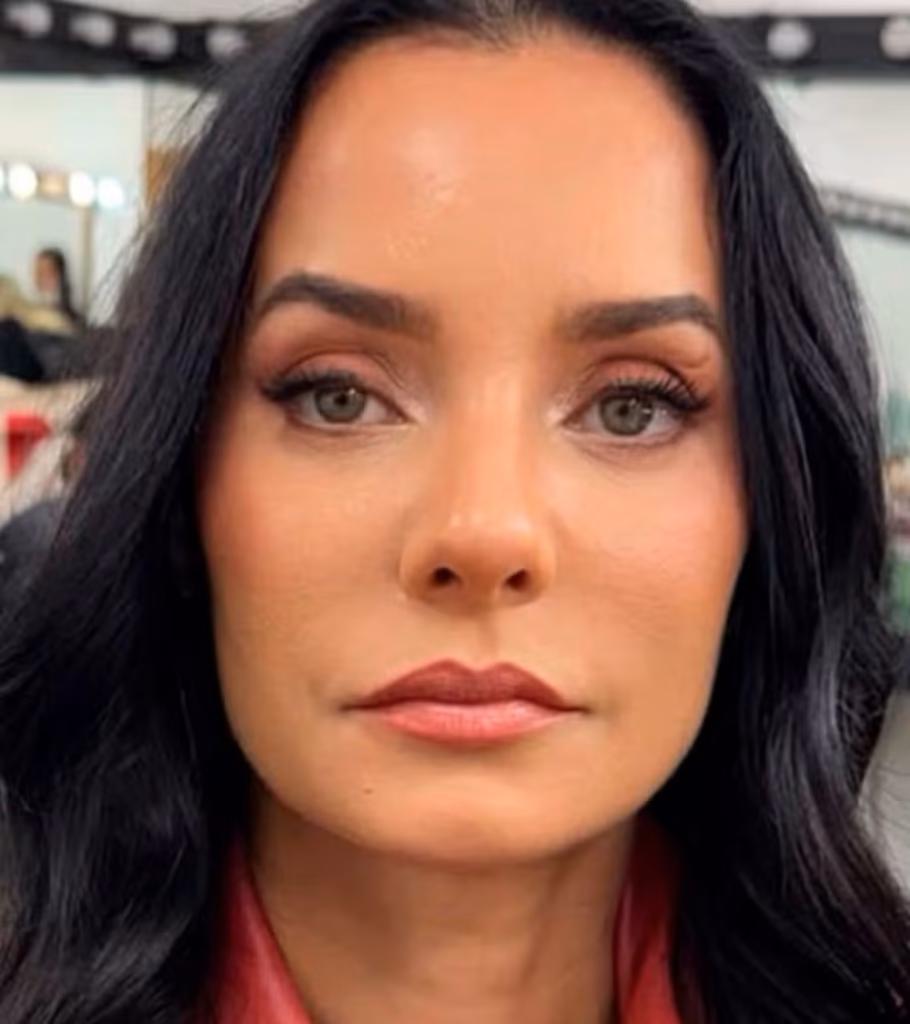Atriz Mônica Carvalho passa por harmonização facial — Foto- @fofocalizando:Reprodução:Instagram