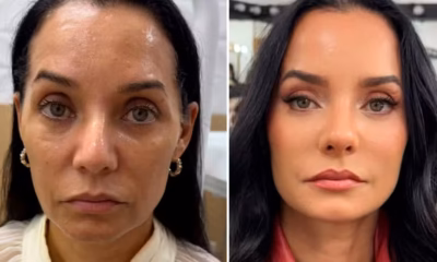 Atriz Mônica Carvalho passa por harmonização facial — Foto- @fofocalizando:Reprodução:Instagram