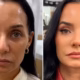 Atriz Mônica Carvalho passa por harmonização facial — Foto- @fofocalizando:Reprodução:Instagram
